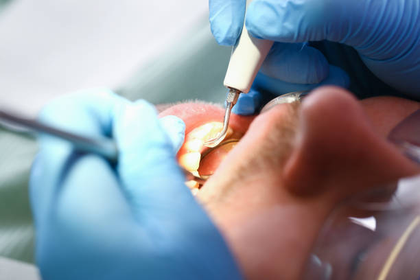 Best Emergency Treatment for Toothache in Altavista, VA