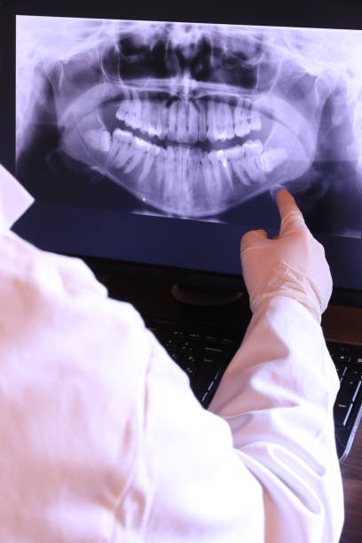 Best Emergency Wisdom Teeth Removal in Altavista, VA