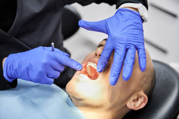 Best Emergency Tooth Extraction in Altavista, VA