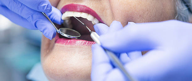 Best Emergency Broken Tooth Repair in Altavista, VA